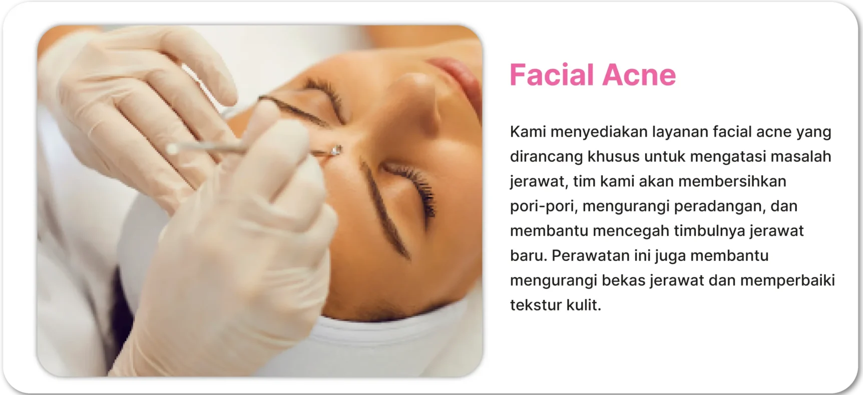 facial acne-perawatan wajah